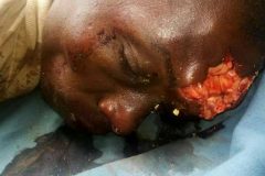 Yaounde has no idea how many innocent Southern Cameroonians it’s killing