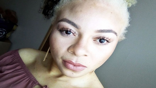 Cameroonian Albino mocked by people who believed she was ‘cursed’ becomes model
