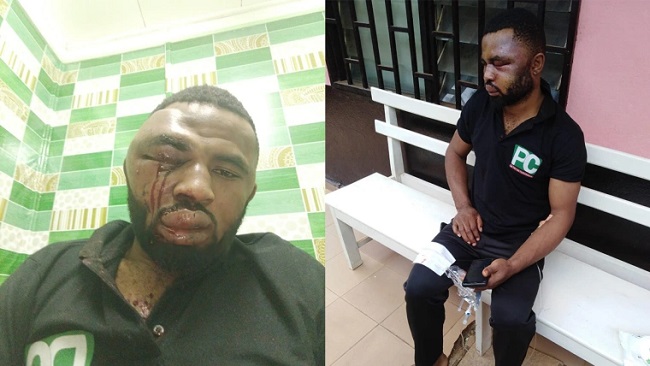 Paul Chouta Cameroon Web reporter Paul Chouta assaulted again in Yaoundé by Secret Service agents