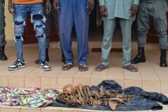 Human body parts Cameroon under Biya: graves are being desecrated, human bones packaged and sold